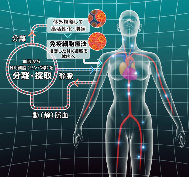 がん免疫細胞治療のしくみ