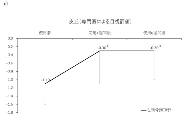 ＊p＜0.05 （vs.使用前）