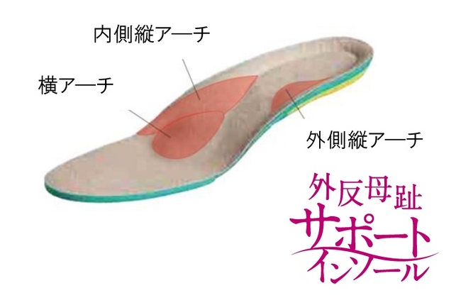 外反母趾サポートインソール