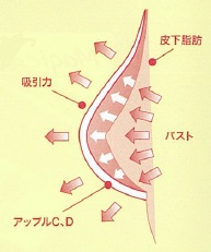 吸引のしくみ