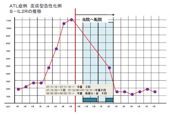 ATL症例 皮膚型急性化例　S-IL2Kの推移
