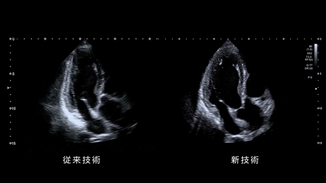 「iBeam Slicing」技術