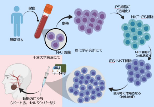 iPS-NKT細胞を腫瘍栄養動脈内にカテーテルを用いて到達させて投与