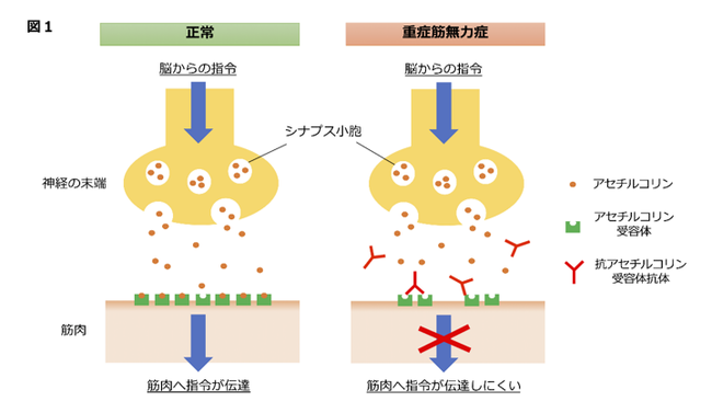 図1：アセチルコリンの作用と重症筋無力症の仕組み