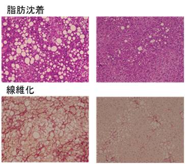 図２．　アスタキサンチンにより、脂肪肝が改善