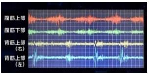 ▲ワンダーコア使用時の筋電図の写真 バランスよく腹筋と背筋を鍛えられている