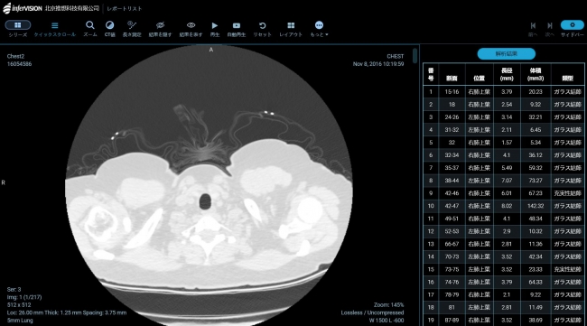 User interface for Doctors