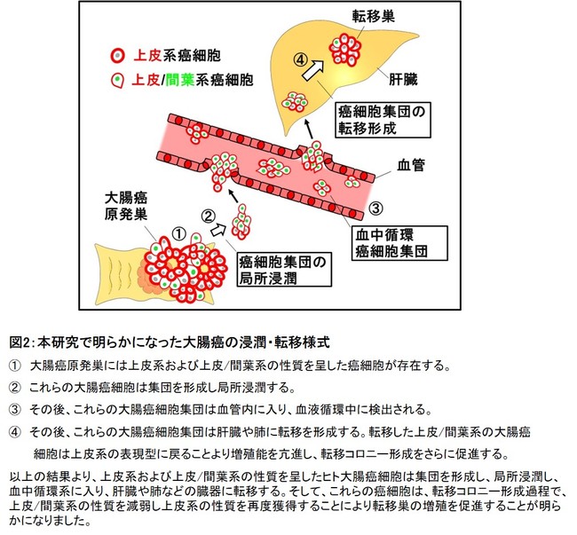 図2：本研究で明らかになった大腸癌の浸潤・転移様式