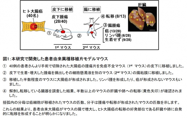 図1：本研究で開発した患者由来異種移植片モデルマウス