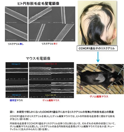 図1：　本研究で明らかになったCCHCR1遺伝子におけるリスクアリルの有無と円形脱毛症との関連