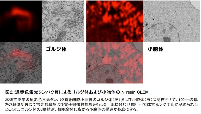 図２：遠赤色蛍光タンパク質によるゴルジ体および小胞体のin-resin CLEM