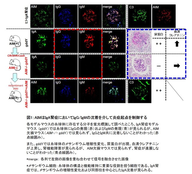 図1：AIMはIgA腎症においてIgG・IgMの沈着を介して炎症起点を制御する