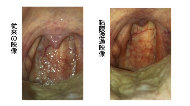 粘膜透過映像技術