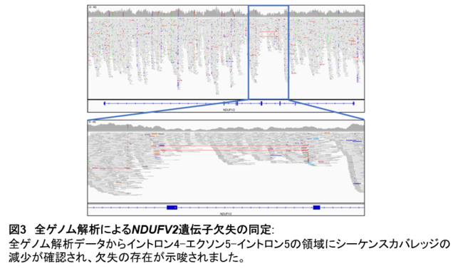 【図3】全ゲノム解析によるNDUFV2遺伝子欠失の同定