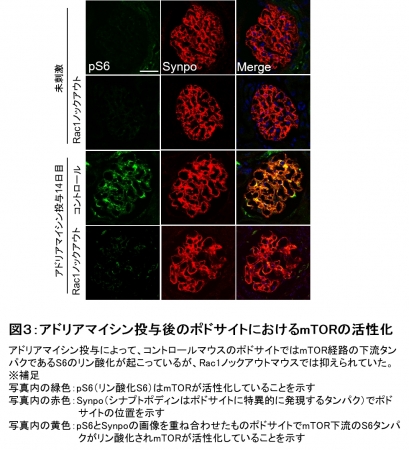 図３：アドリアマイシン投与後のポドサイトにおけるmTORの活性化