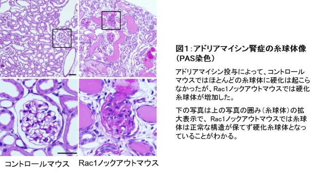 図１：アドリアマイシン腎症の糸球体像（PAS染色）