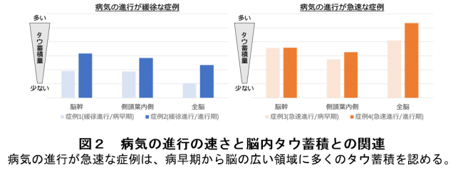 図２　病気の進行の速さと脳内タウ蓄積との関連