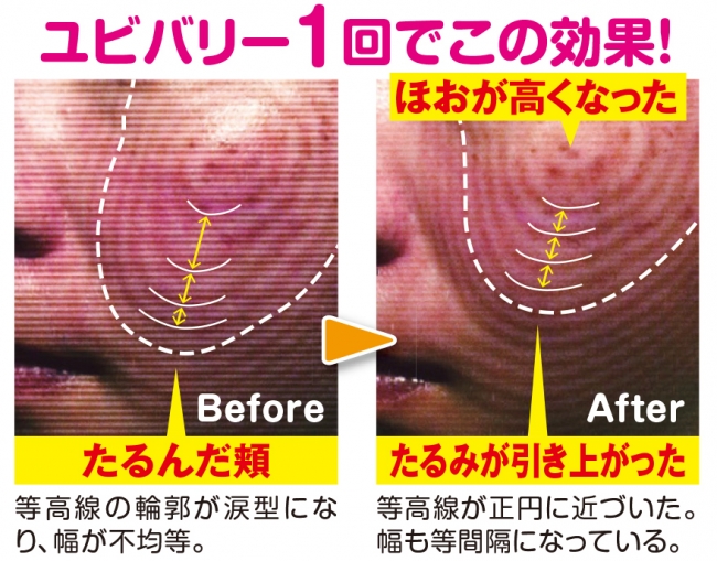 「ユビバリー」体験セミナー会での変化