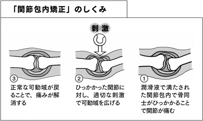 ↑酒井先生が編み出した「関節包内矯正」のしくみ。これをセルフケア用に改良したのが本書で紹介する「関節ストレッチ」の数々。