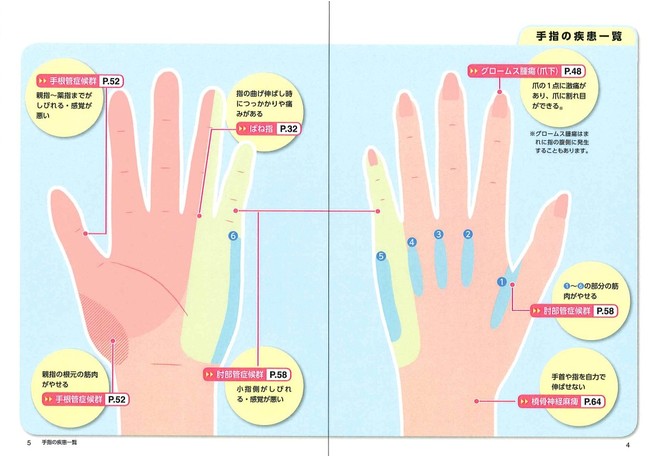 小さな手の中でもさまざまな箇所で不具合は生じ、原因や対処法も異なる。まずは自分の症状がどの位置でどのように発生しているかを冷静に見極めることが重要