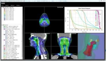 放射線治療計画支援システム『iVAS』の機能強化により、がん治療をサポートします。