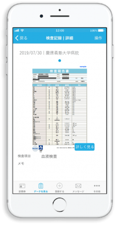 MeDaCaアプリ上での検査結果表示イメージ