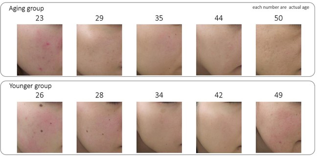 図1　AgingグループとYoungerグループの被験者の肌画像
