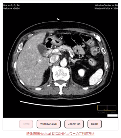 Webブラウザ上で閲覧できるDICOMビューア