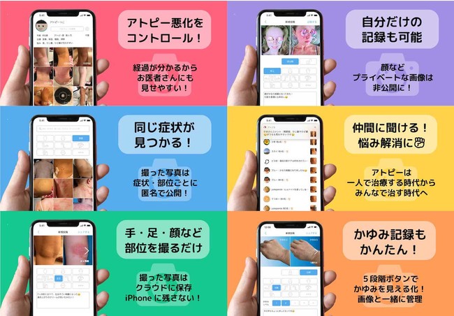 アトピヨとは・総務省「OPEN 異能 (inno)vation 2020」-アトピヨ