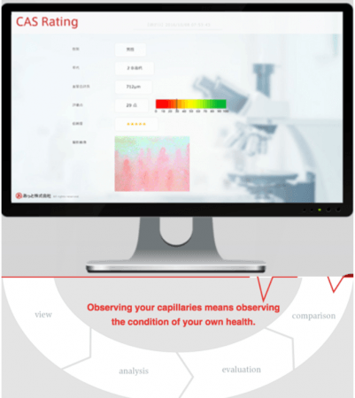 毛細血管画像評価システム「CAS-Rating」