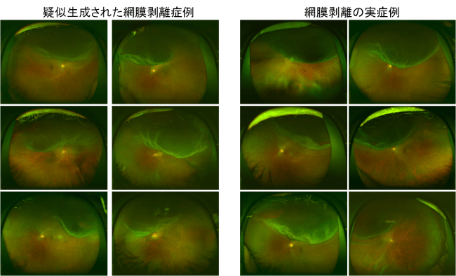 実症例画像との比較