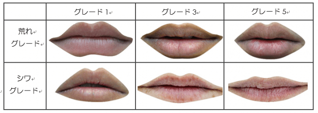 Fig１：唇の荒れ、シワのグレード