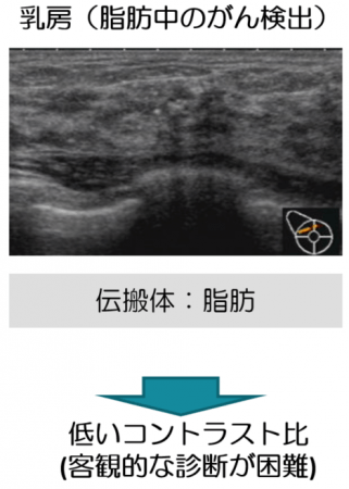 図４：乳がん検診における超音波関連技術の本質的課題.