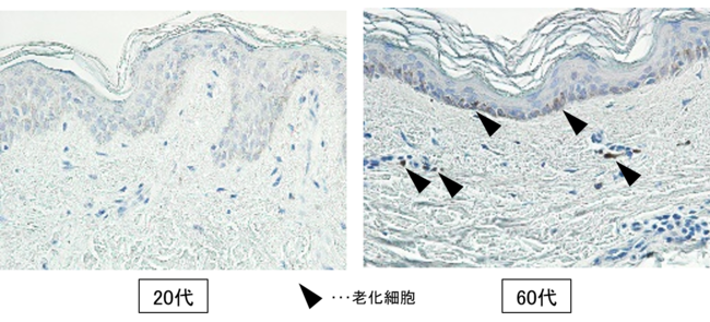 図１　加齢に伴い老化細胞が蓄積する