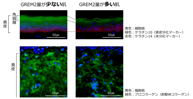 図４ GREM2量の異なる高齢者の肌