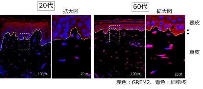 図１ 加齢による肌のGREM2量の変化