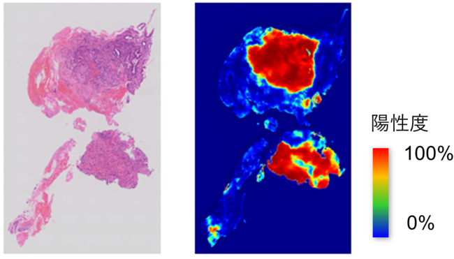 図4. AI病理診断支援ソフトウェアの 推論結果イメージ