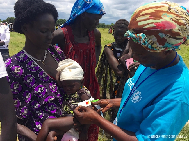 栄養不良の検査を受ける子ども。 (2017年8月撮影) © UNICEF_UN0120044_Makundi