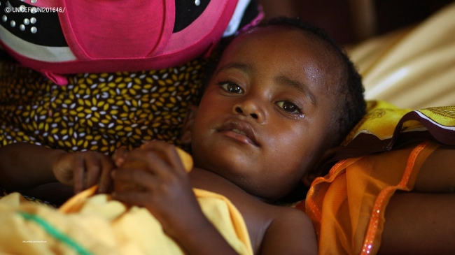 肺炎に苦しむ1歳半の子ども。(マダガスカル)2015年11月撮影© UNICEFUNI201646