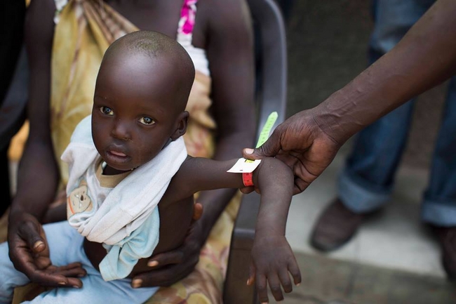 世界で最も若い国である南スーダンでは、多くの子どもたちが重度の栄養不良に陥る危険性がある。© UNICEF South Sudan/2014/Knowles_Coursin