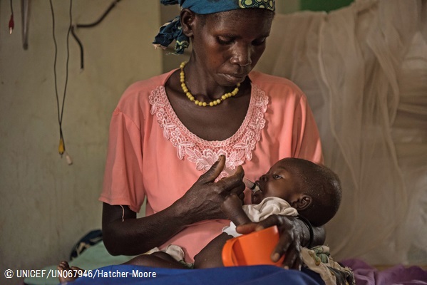 栄養治療食を与えられる9カ月の子ども(南スーダン・ジュバ) 2017年3月15日撮影© UNICEF_UN067946_Hatcher-Moore