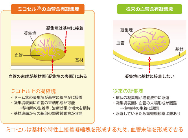 図1：ミコセル上の血管含有細胞凝集塊の特徴