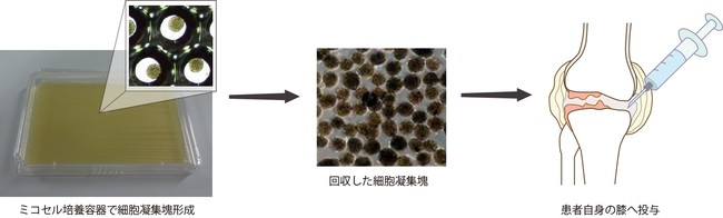 図「ミコセル」を用いた変形性膝関節症に対する臨床研究の概要