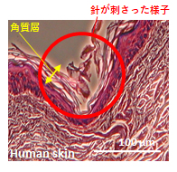 肌表面の弾力に負けず刺さっているか、 ヒト皮膚試験を実施。上図のように角質層までマイクロニードルが届いたかどうかの確認を行っています。