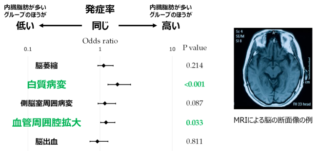 図3 内臓脂肪と脳の構造の関係性