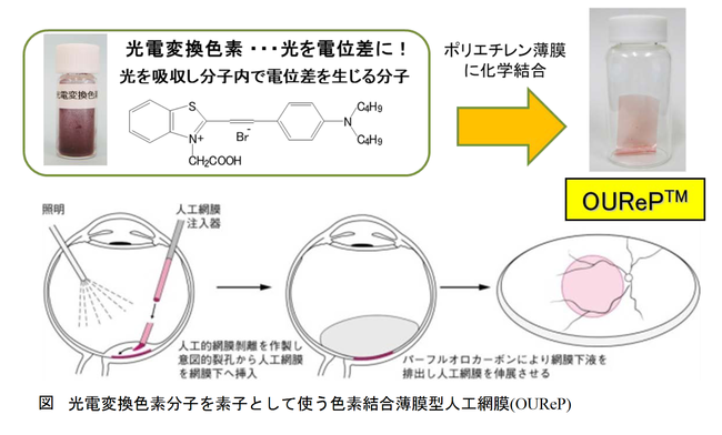 光電変換色素分子を素子として使う色素結合薄膜型人工網膜（OUReP™）