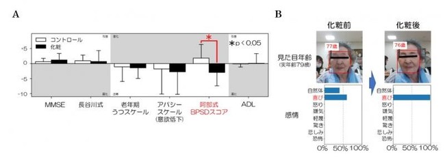 A．化粧療法で情動症状（BPSD）が改善　　B．AI顔解析で見た目年齢が若返り、喜びが増加