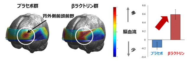 図1 34CH光トポグラフィーを用いた脳血流測定の結果