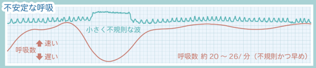 不安定な呼吸イメージ