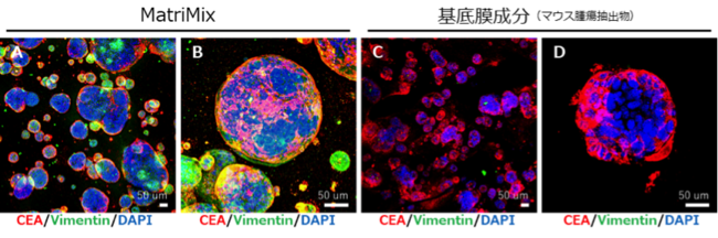 図3　MatriMix (511) を用いたヒト患者由来大腸がんオルガノイド形成